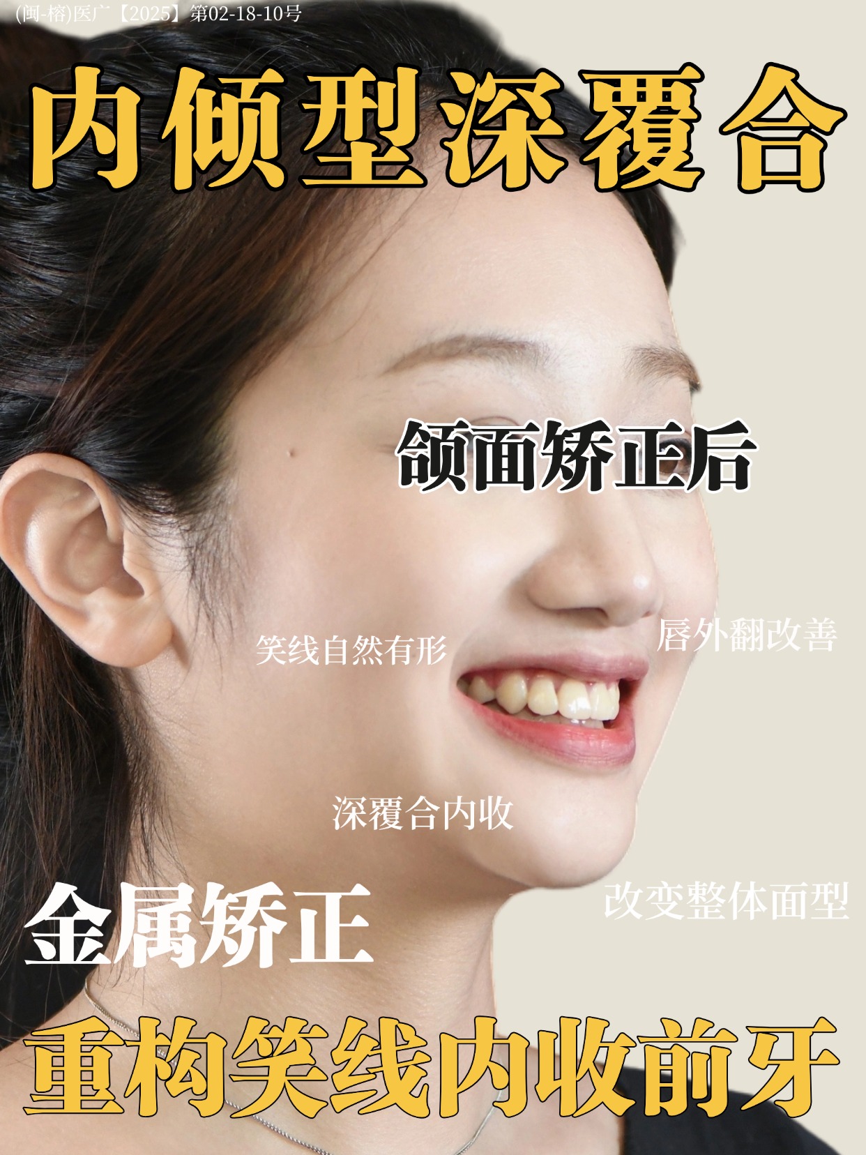 金箔风颌面矫正患者女性人物牙齿矫正场景人像照片 | AI智能生成设计模板-千图AI