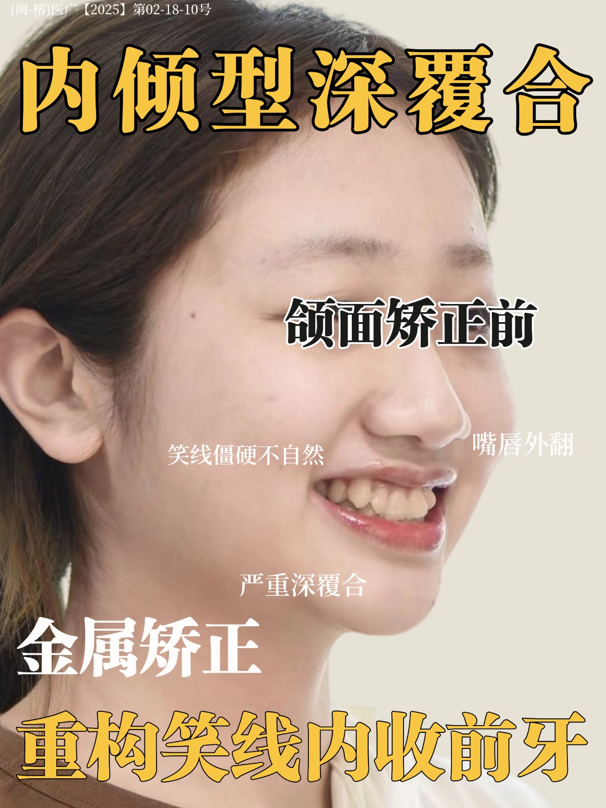 女性女孩女士颌面矫正场景人像照片 | AI智能生成设计模板-千图AI